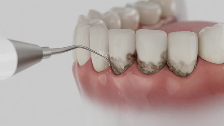 Reliable Tooth Extraction contractor in Pine Grove, CA by Smile Center Dentistry